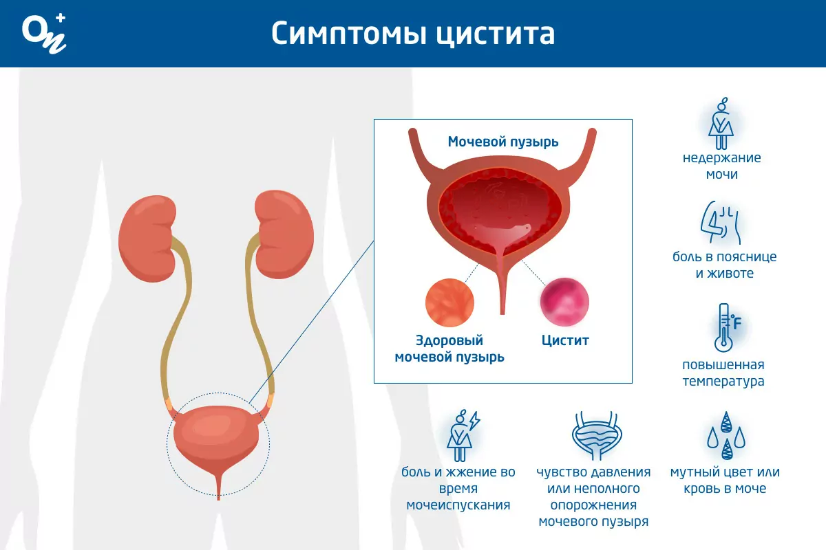 Зуд во влагалище