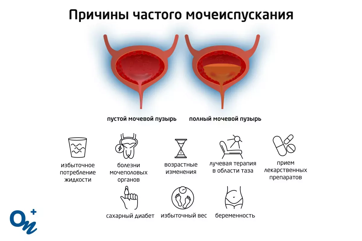 Затрудненное мочеиспускание у женщин