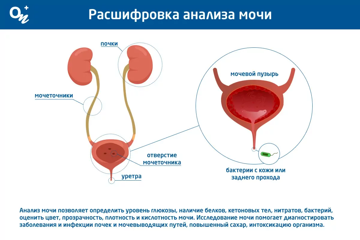 Что показывает анализ мочи и как его расшифровать — блог медицинского  центра ОН Клиник