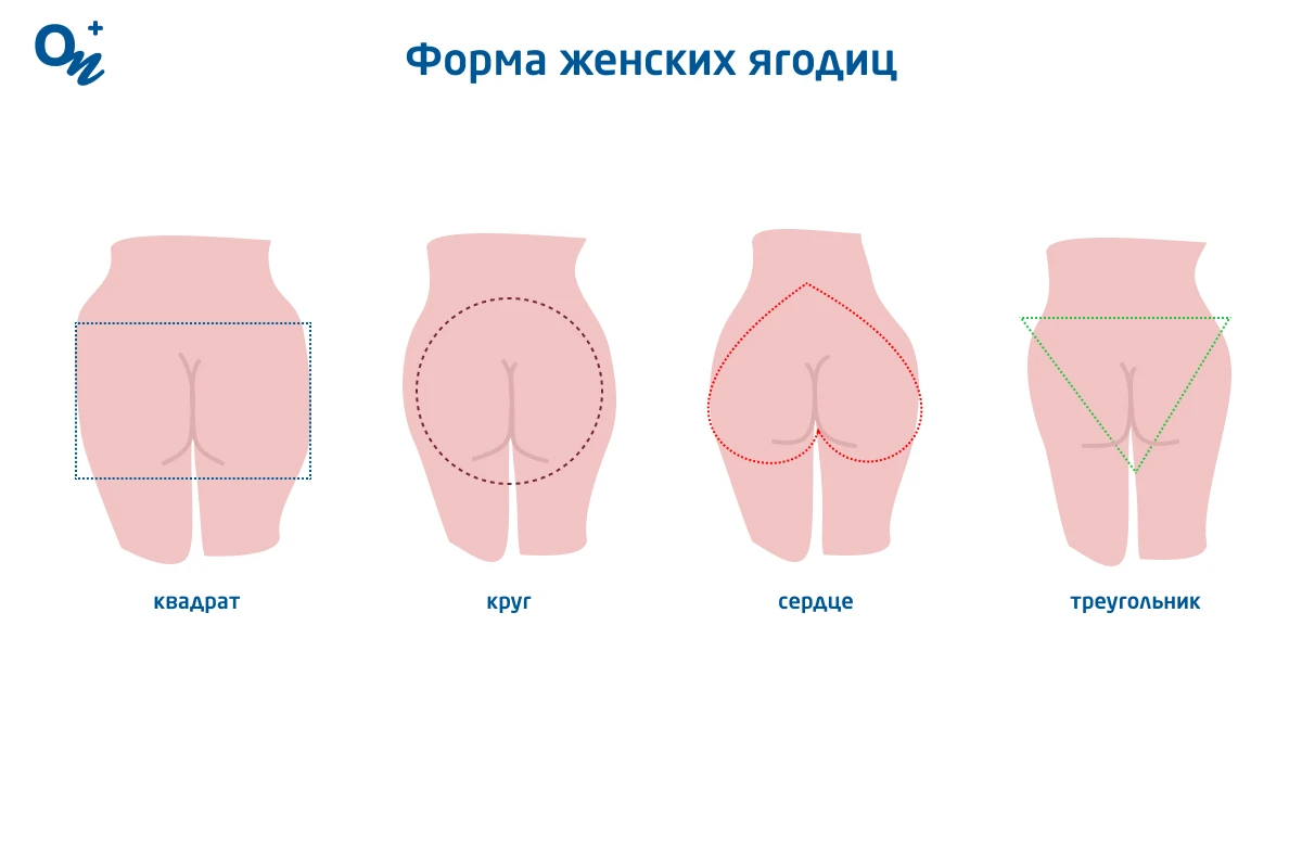 Какие изменить форму и размер ягодиц — блог медицинского центра ОН Клиник