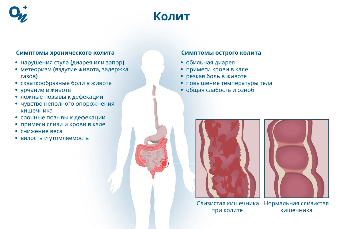 Колит