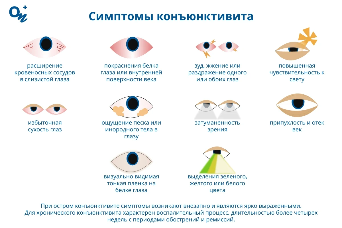 Симптомы конъюнктивита