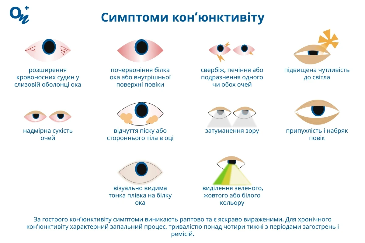 Симптоми кон'юнктивіту