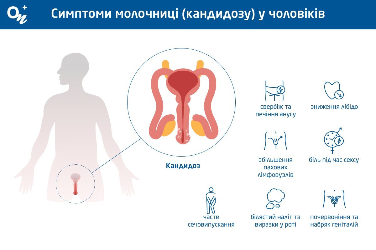 Симптоми молочниці (кандидозу) у чоловіків