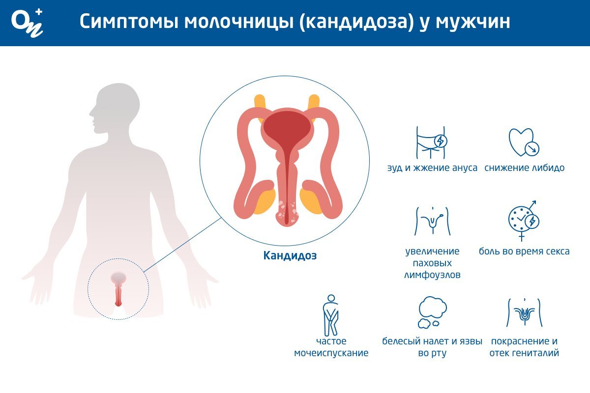 Симптомы молочницы (кандидоза) у мужчин