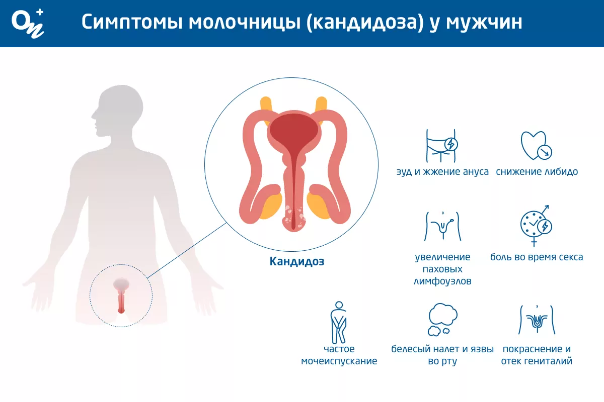 Федеральные клинические рекомендации по ведению больных урогенитальным кандидозом