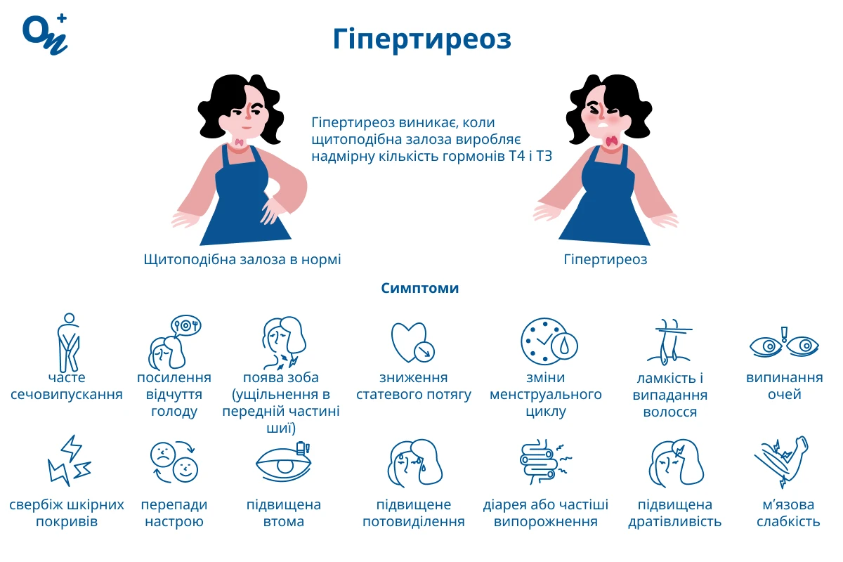 Гіпертиреоз
