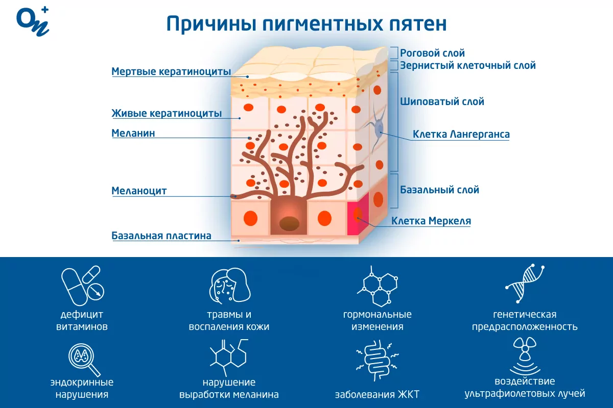 Как убрать пигментные пятна на лице и теле — блог медицинского центра ОН  Клиник