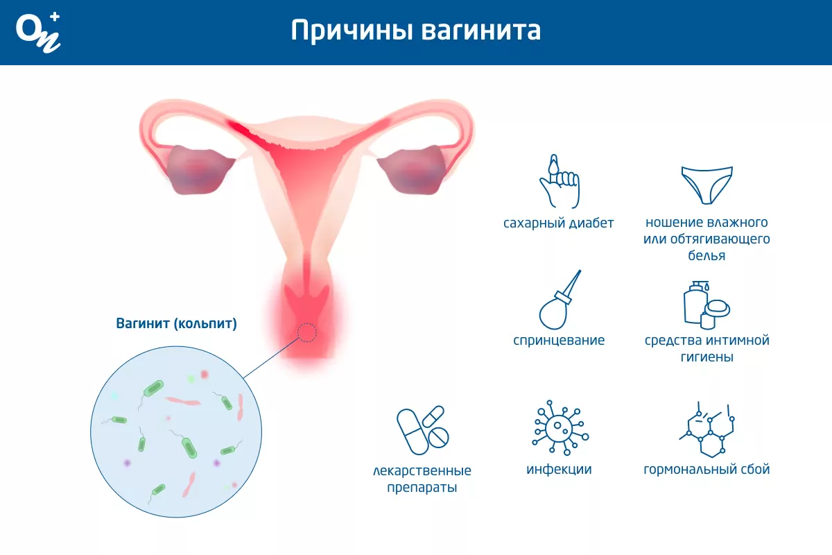 Кольпит (вагинит): причины, симптомы, диагностика, лечение | Клиника «Наедине»