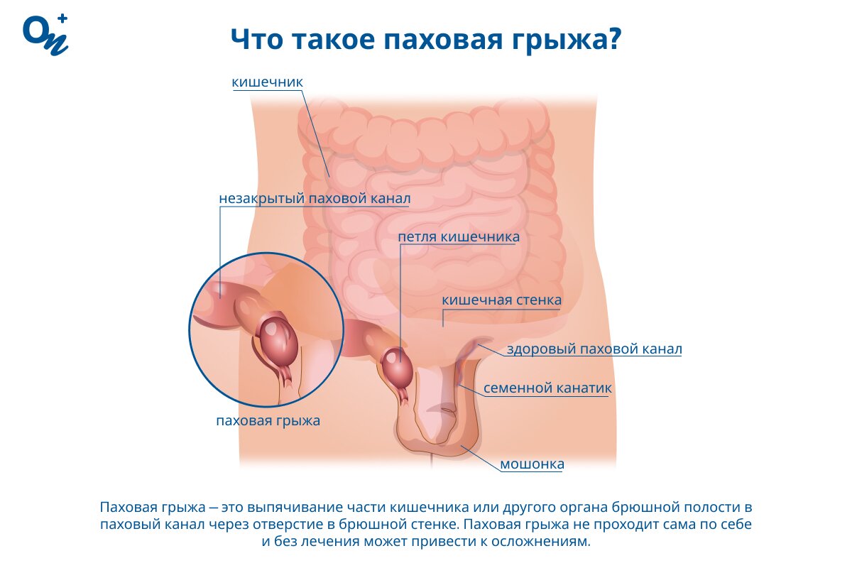 Раскрытая дыра после сексм 