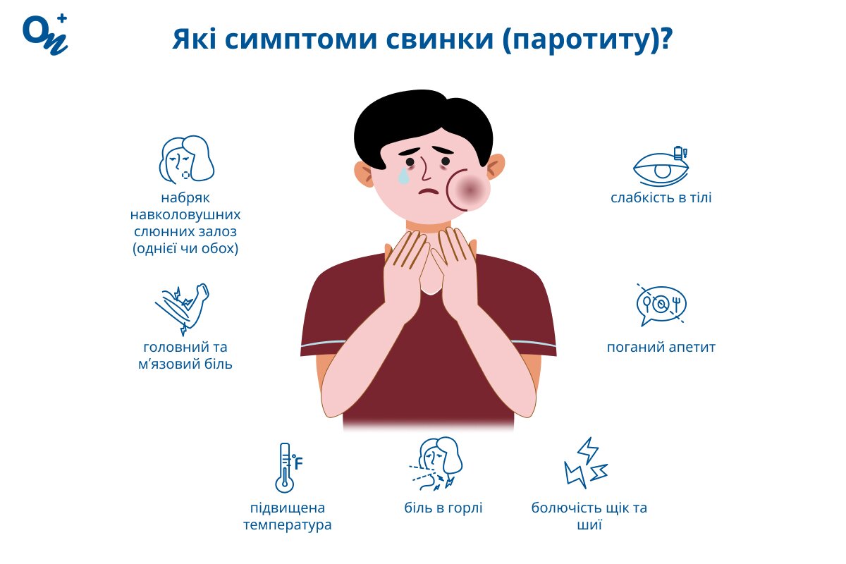 Як проявляється свинка (паротит)?