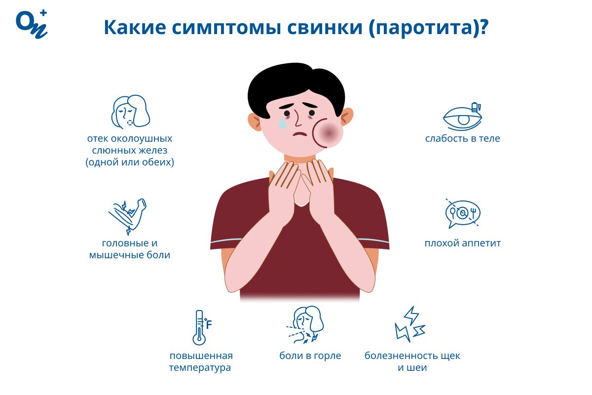 Как проявляется свинка (паротит)?