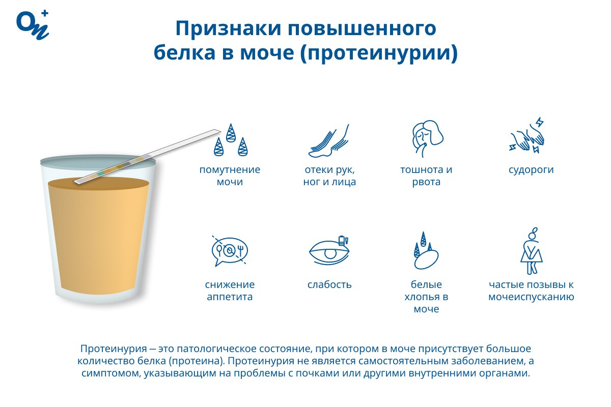 Какие симптомы повышенного белка в моче?