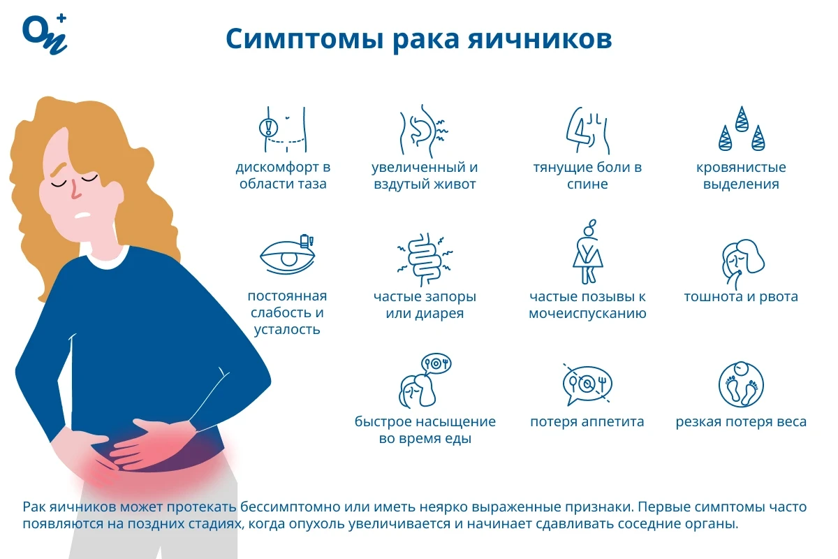 Симптомы рака яичников