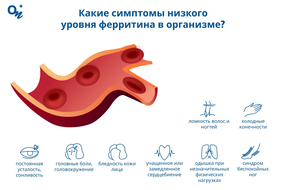 Какие симптомы низкого уровня ферритина?