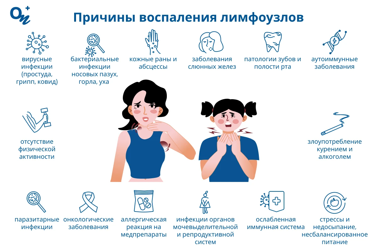 Причины воспаления лимфоузлов