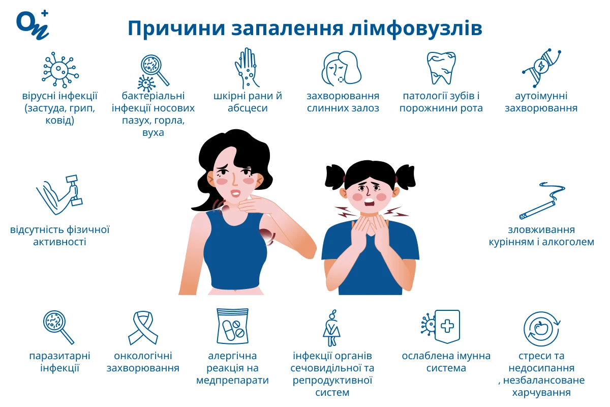 Причини запалення лімфовузлів