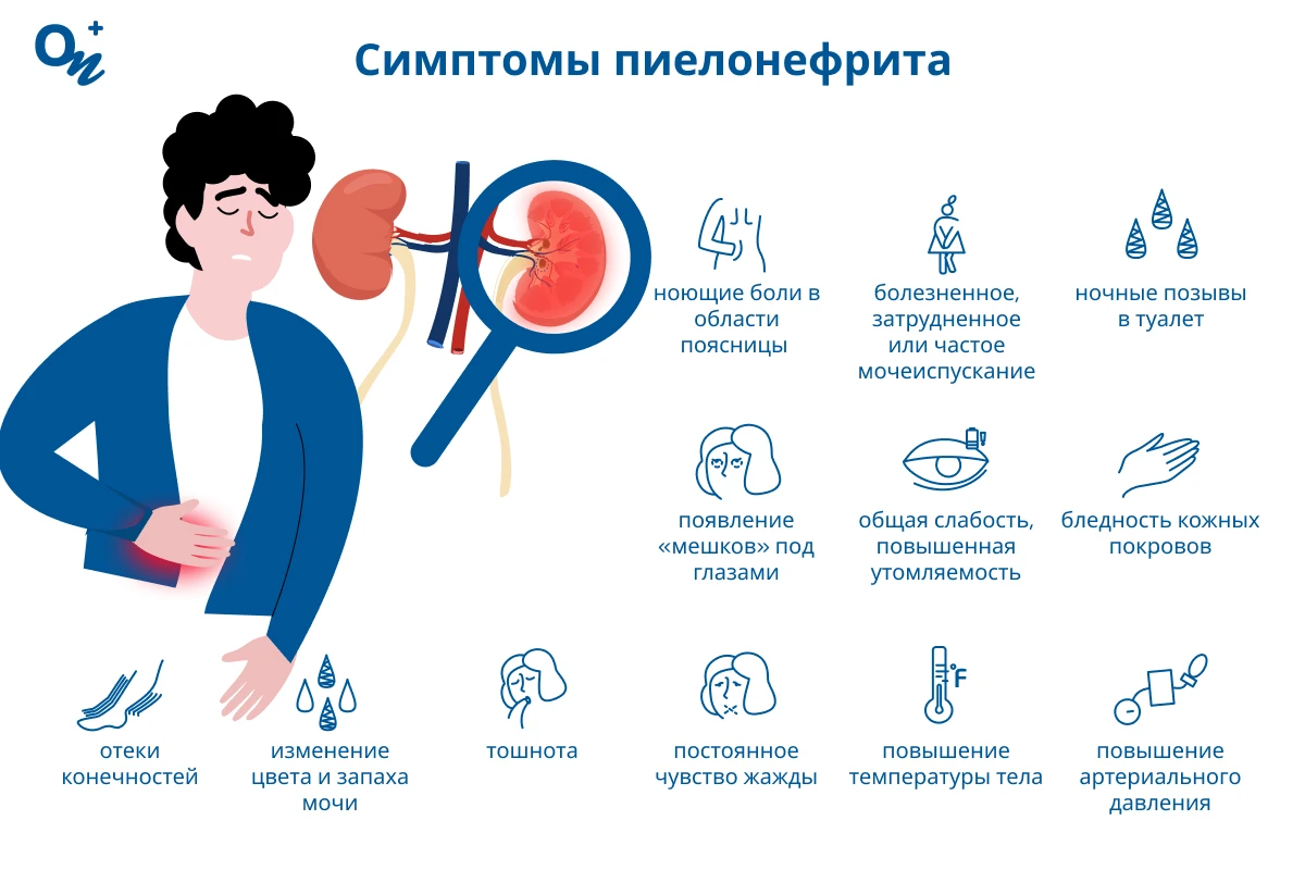 Симптомы пиелонефрита