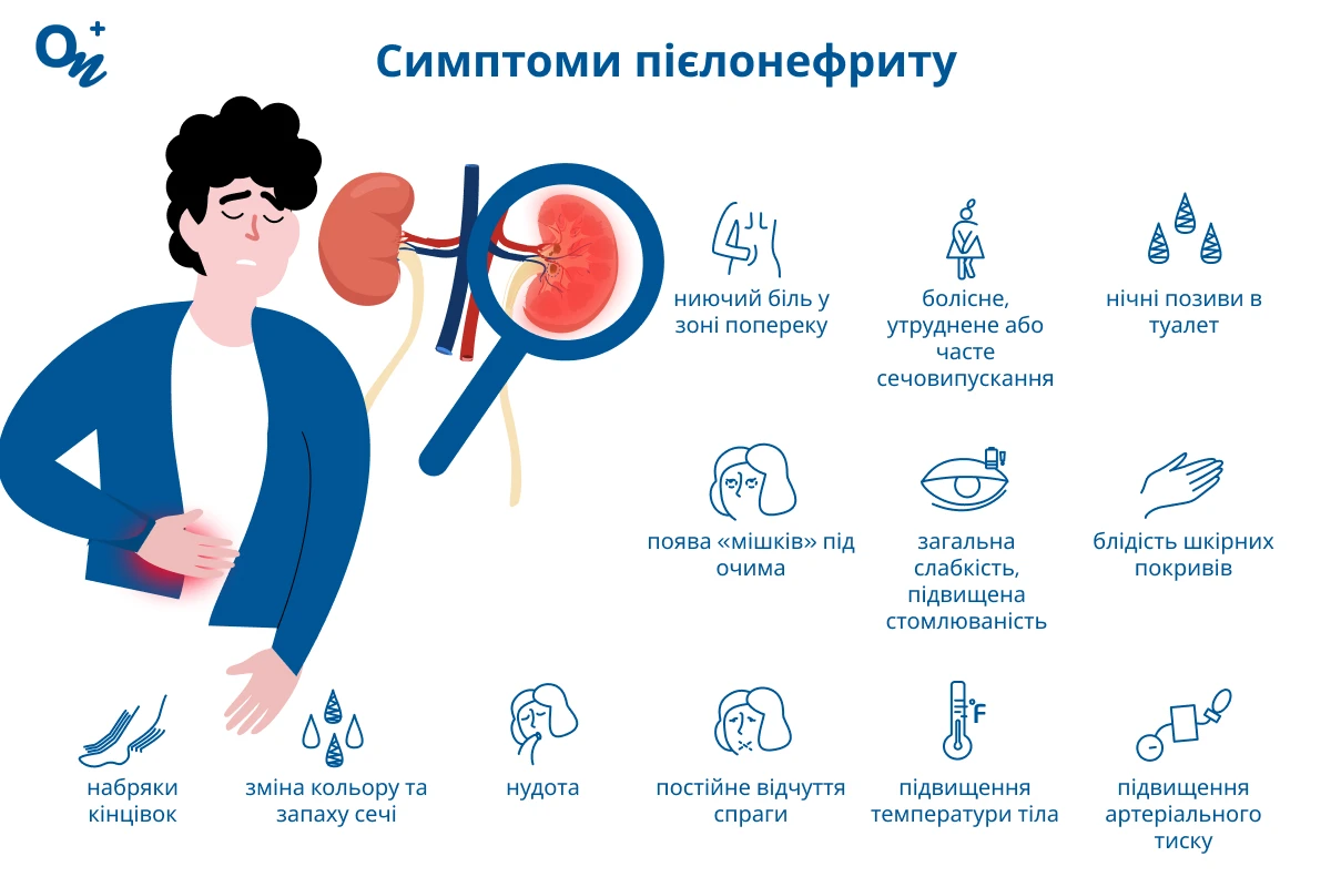 Симптоми пієлонефриту
