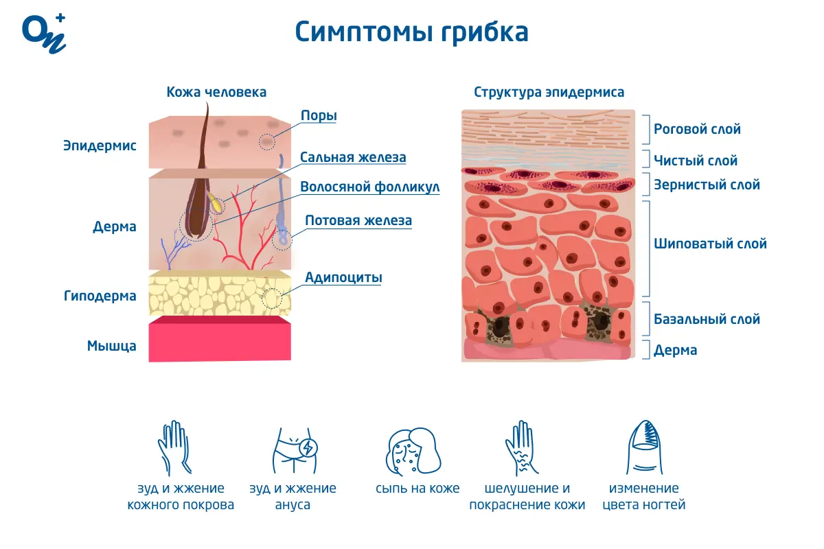 Как распознать и вылечить грибок — блог медицинского центра ОН Клиник