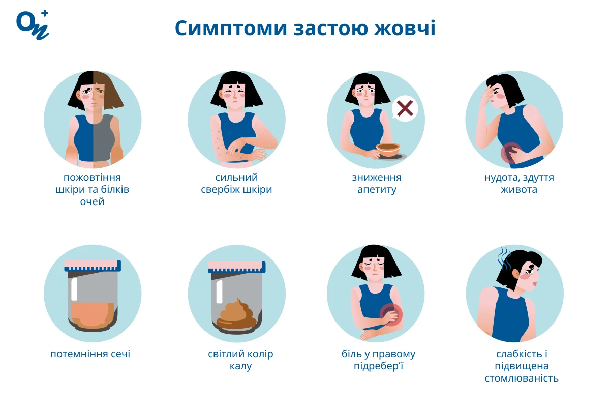 Симптоми застою жовчі