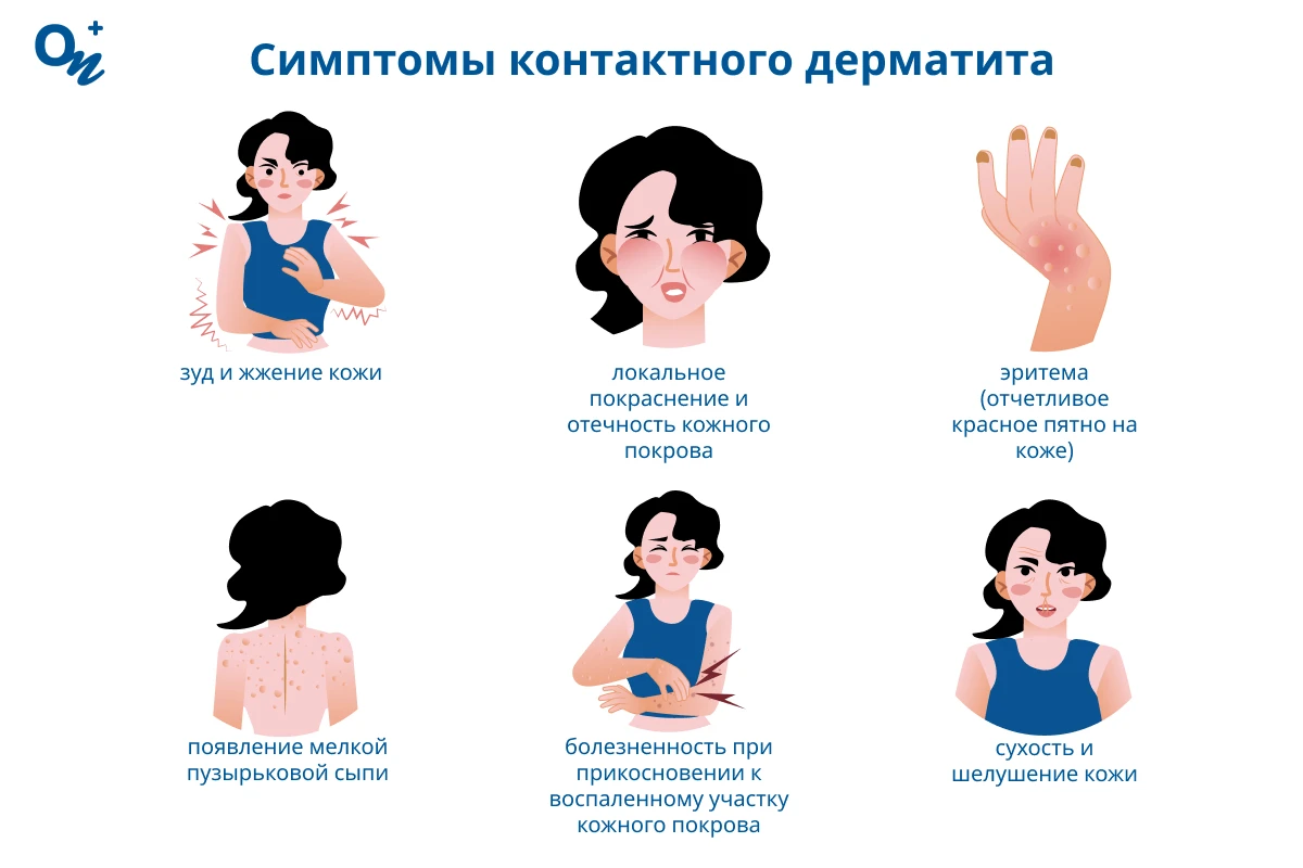 Симптомы контактного дерматита