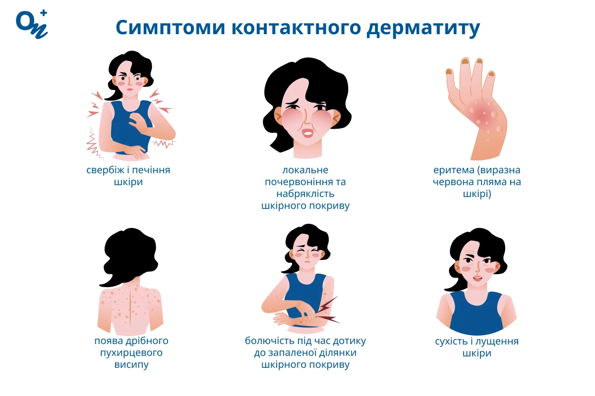 Симптоми контактного дерматиту