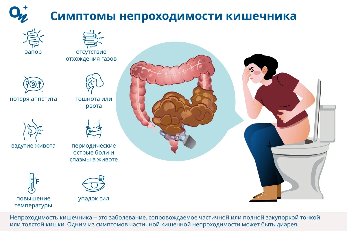 хентай кишечник Непроходимость кишечника: как распознать и как лечить? — блог медицинского  центра ОН Клиник