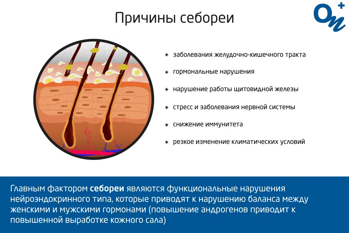 Как вылечиться от себореи и себорейного дерматита — блог медицинского  центра ОН Клиник