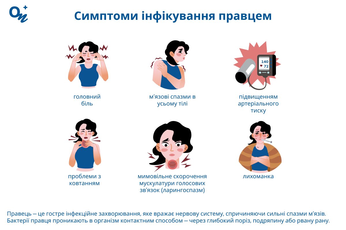 Які симптоми вказують на правець?