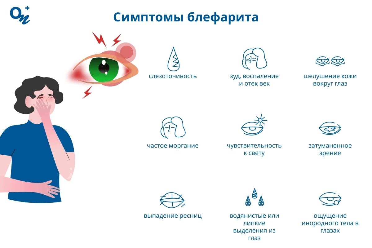 Симптомы блефарита