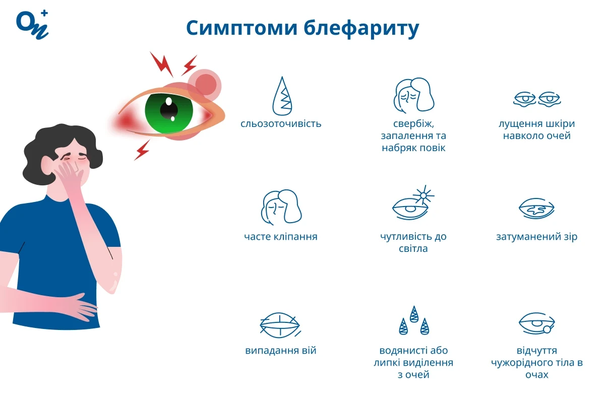 Симптоми блефариту