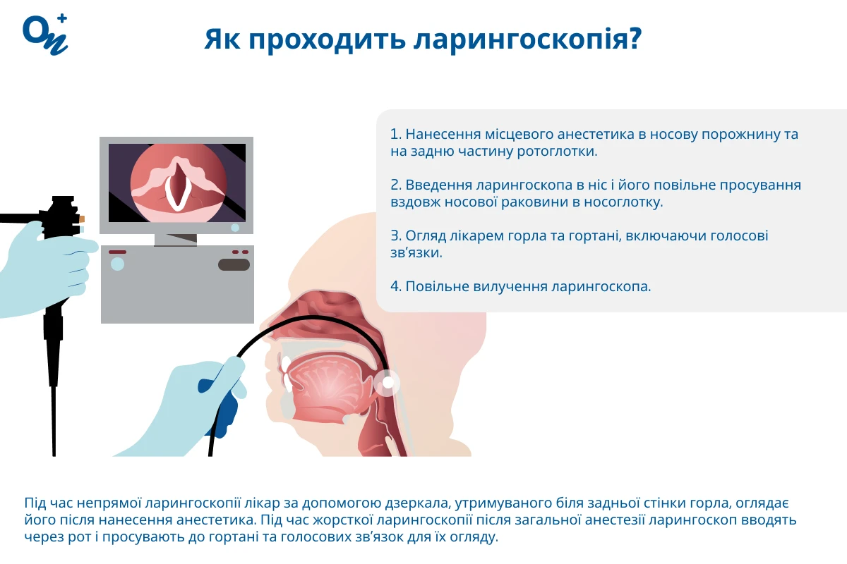 Ларингоскопія