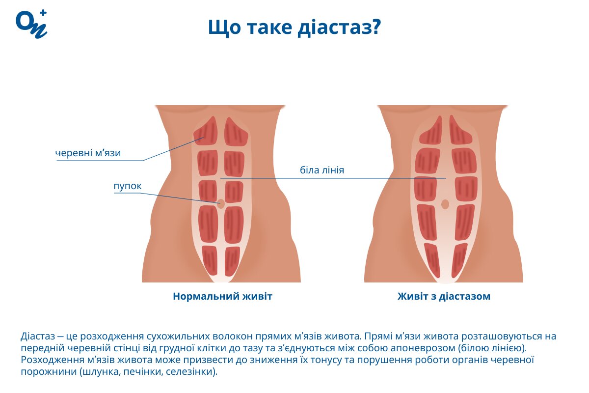 Що таке діастаз?