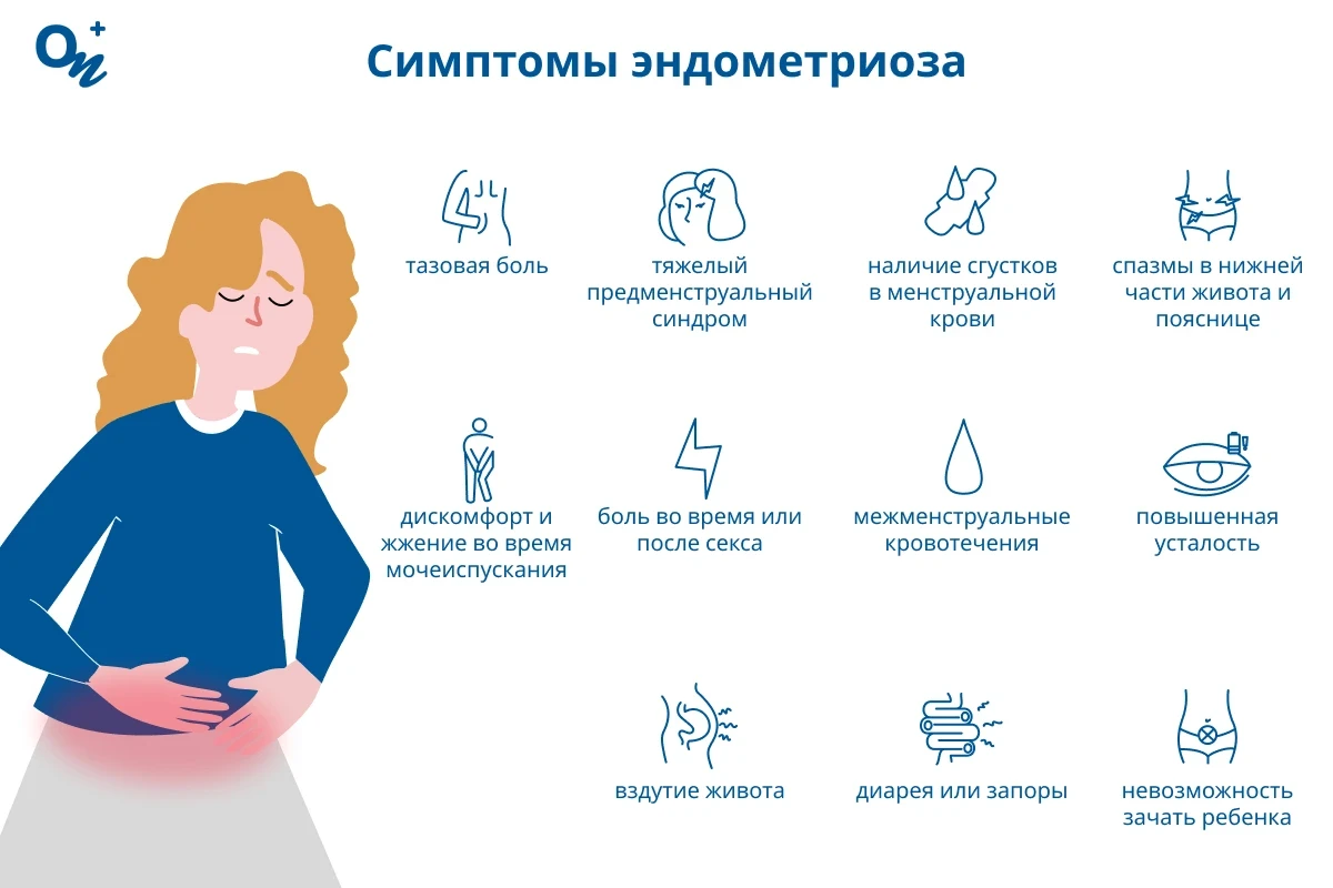 Симптомы эндометриоза