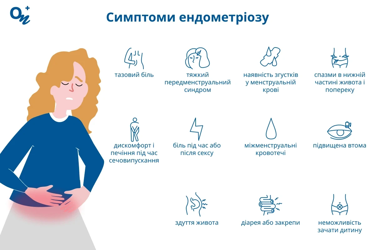 Симптоми ендометріозу