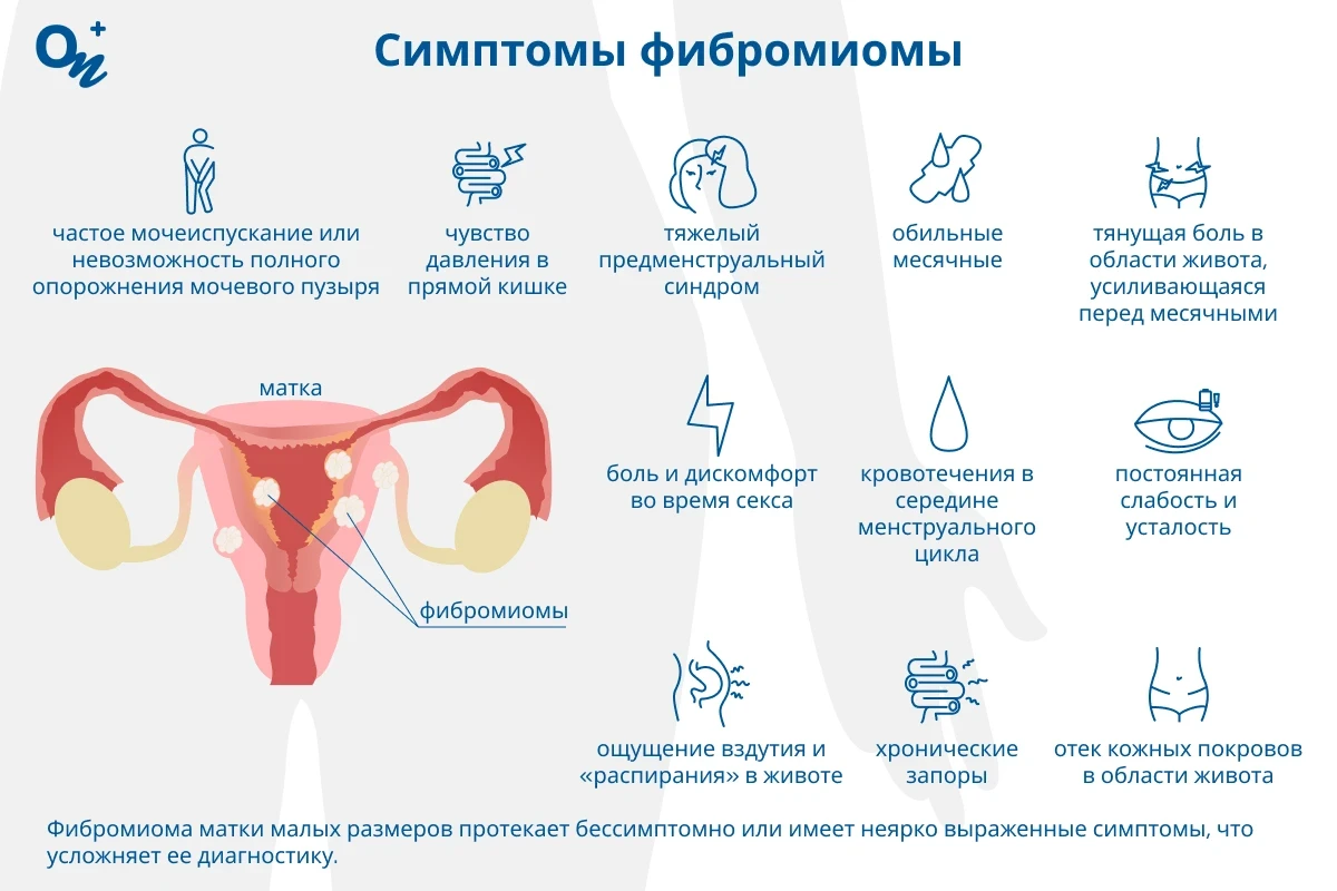 Симптомы фибромиомы