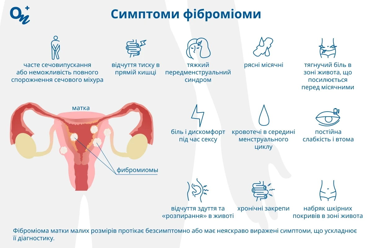 Симптоми фіброміоми