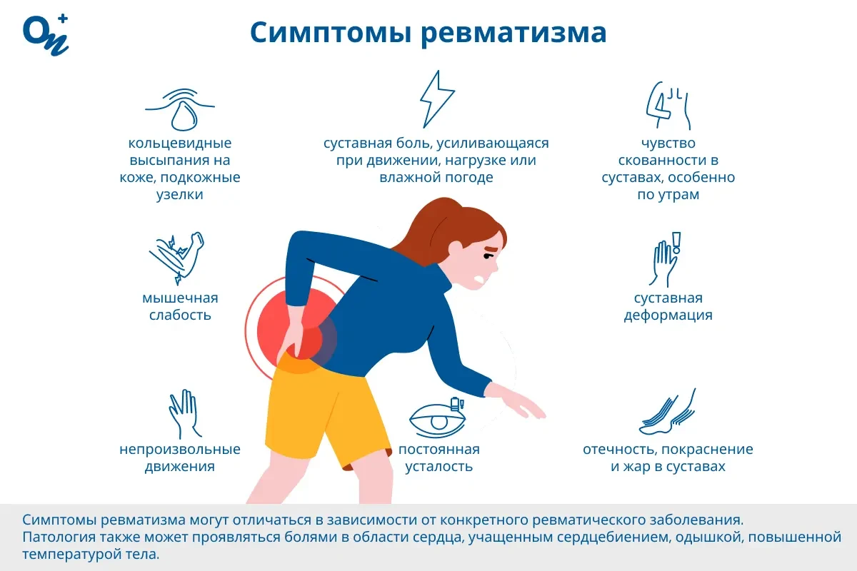 Симптомы ревматизма