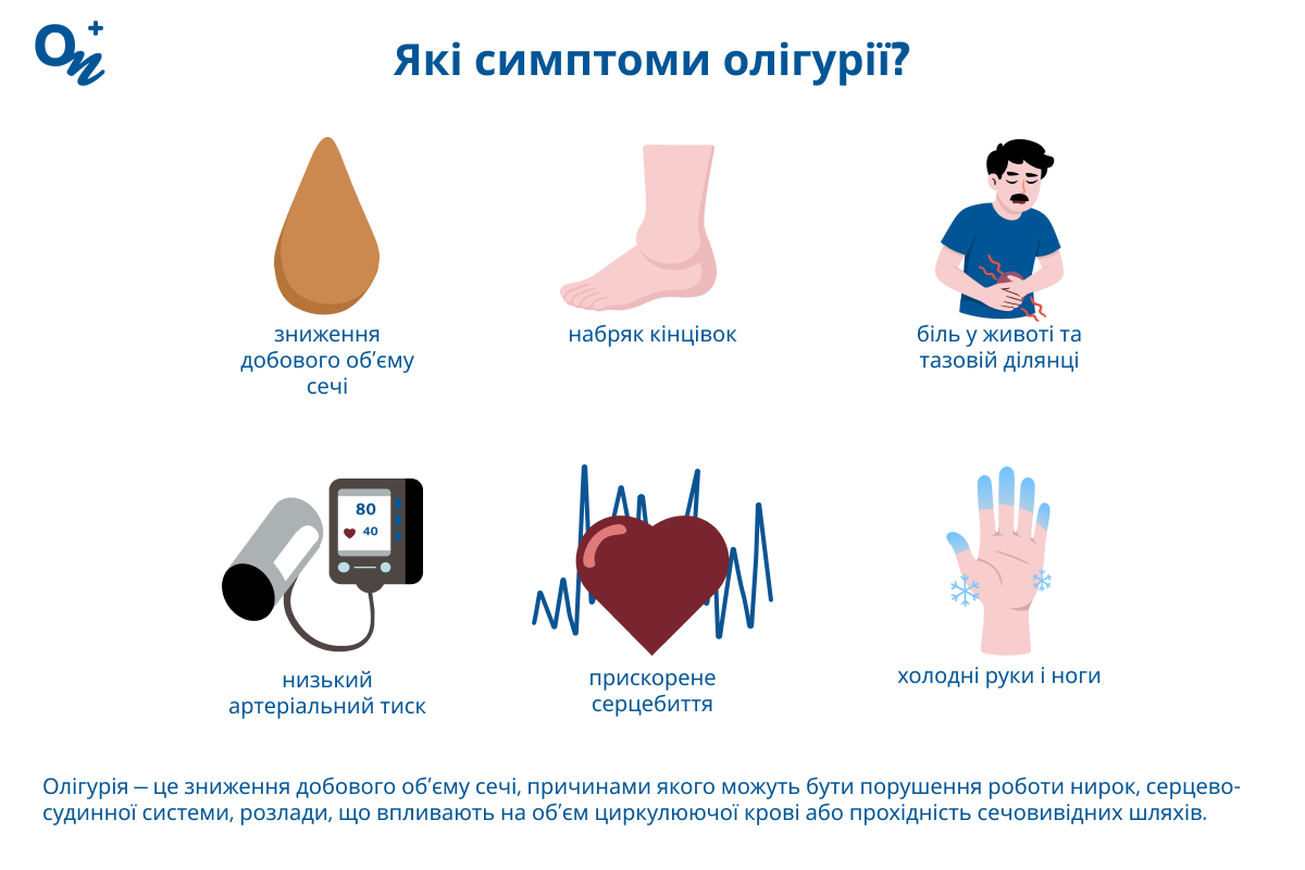 Які симптоми олігурії?