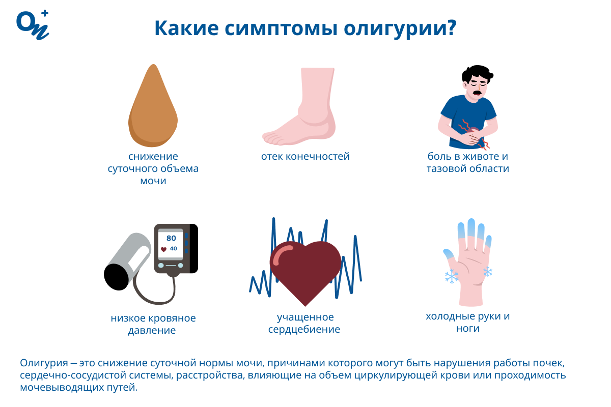 Какие симптомы олигурии?