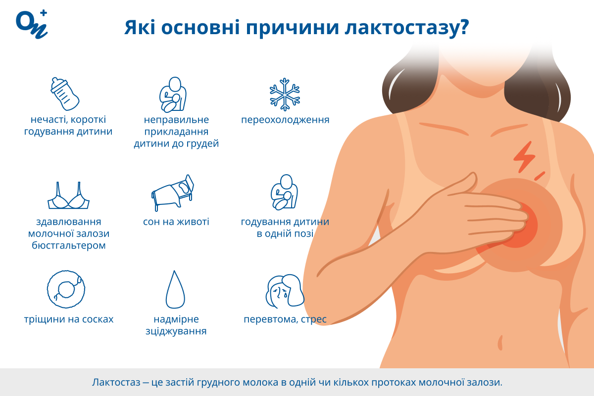 Які причини лактостазу?