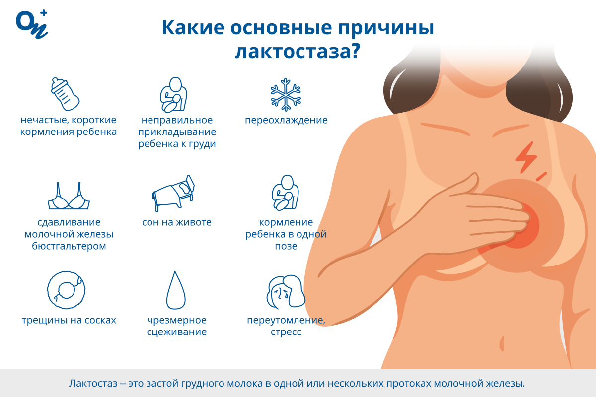 Какие причины лактостаза?