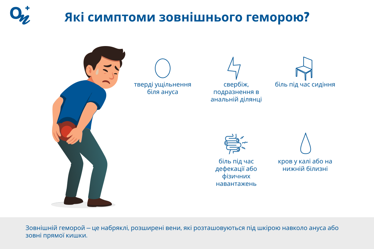 Які симптоми зовнішнього геморою?