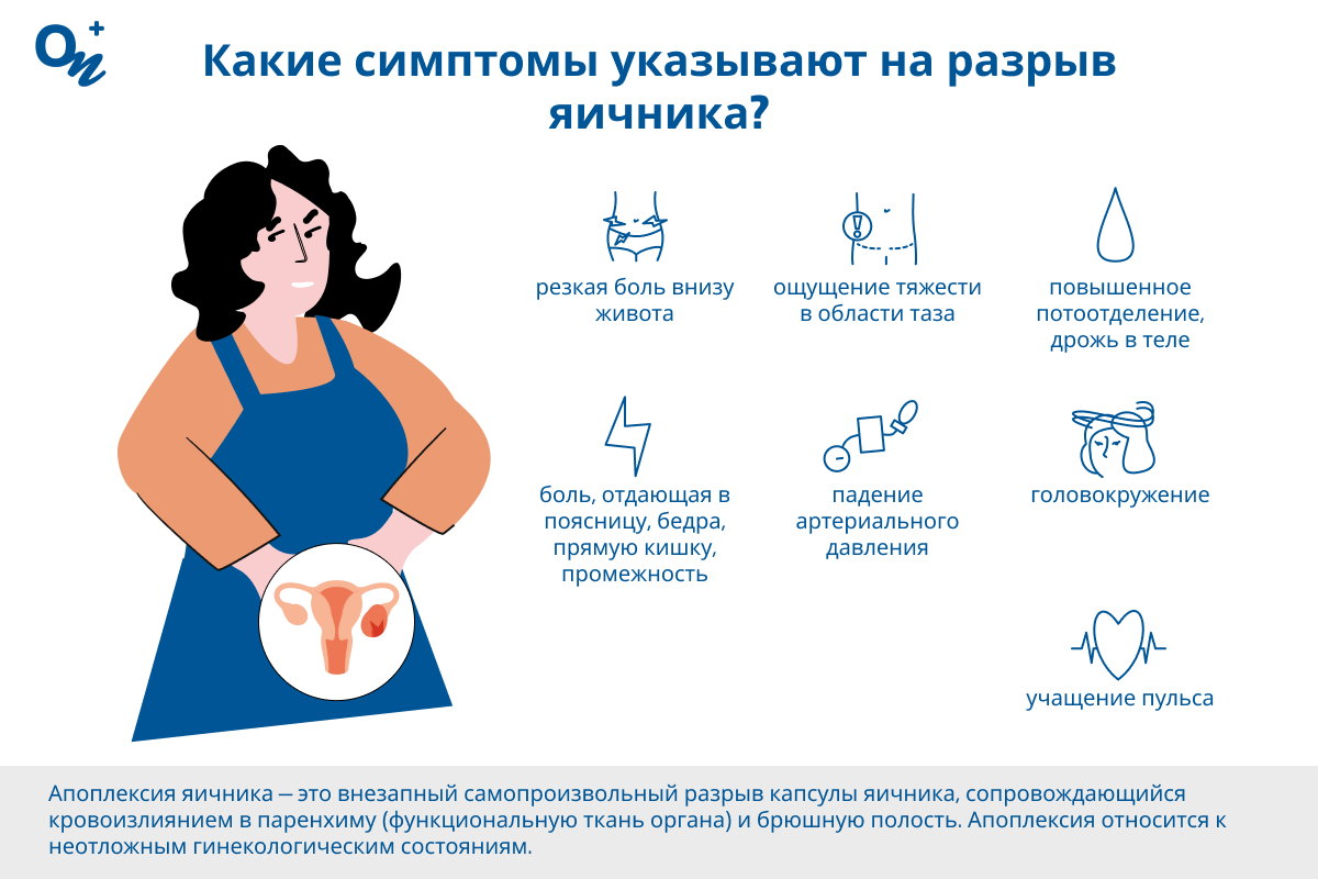 Какие симптомы разрыва яичника?
