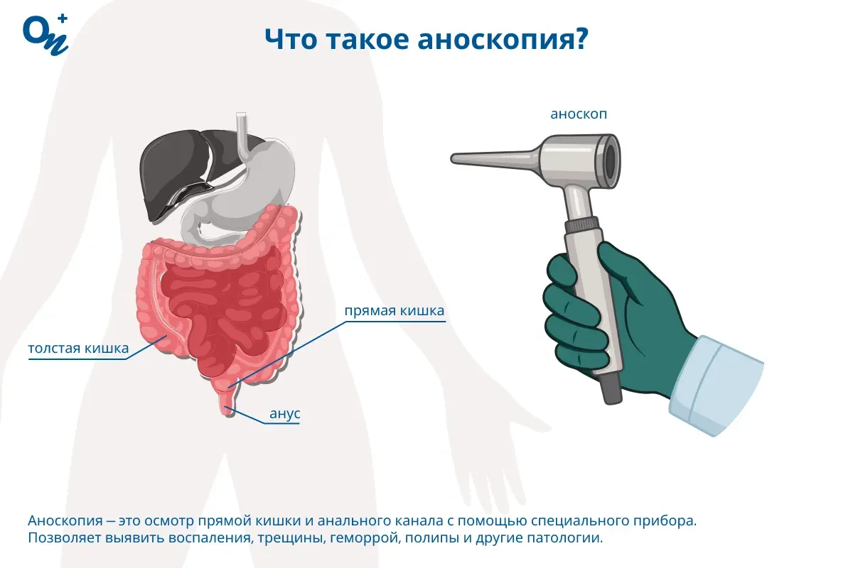 Что такое аноскопия?