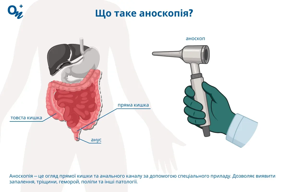 Що таке аноскопія?