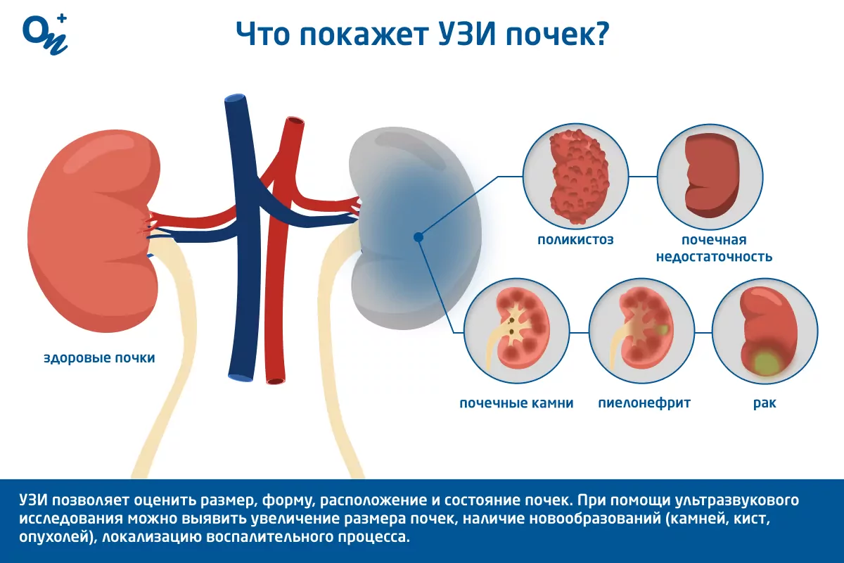 Что показывает УЗИ почек, надпочечников и мочевого пузыря — блог  медицинского центра ОН Клиник