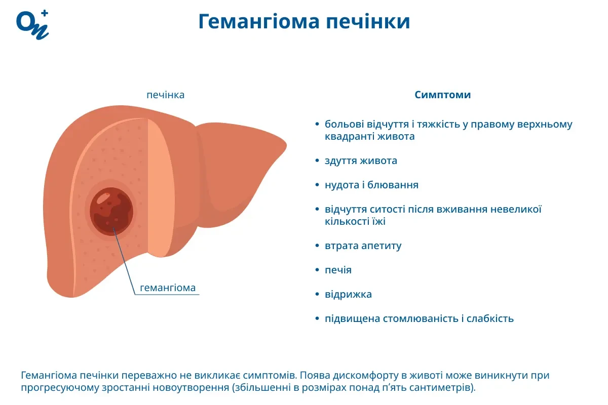 Гемангіома печінки