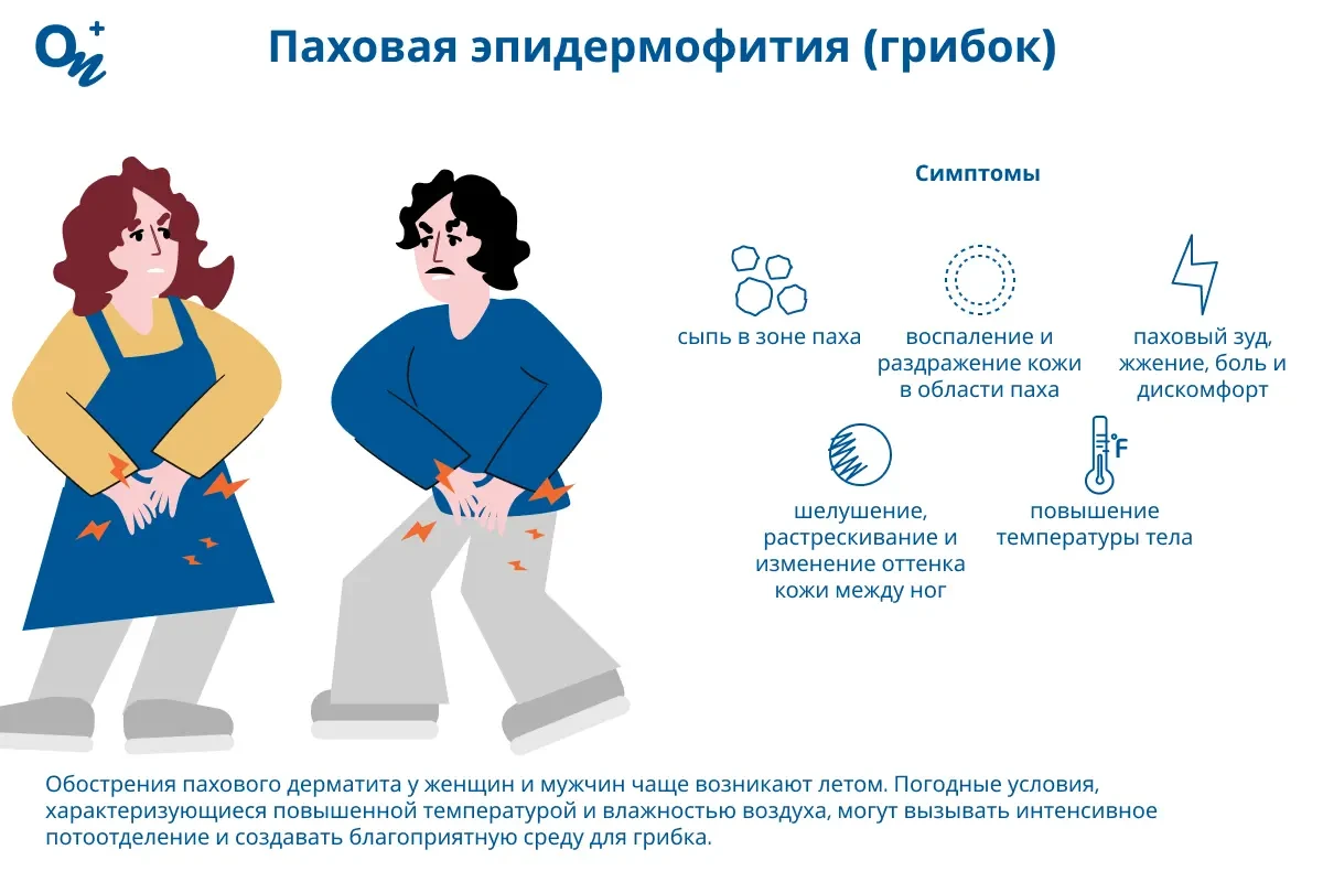 Паховая эпидермофития (грибок)